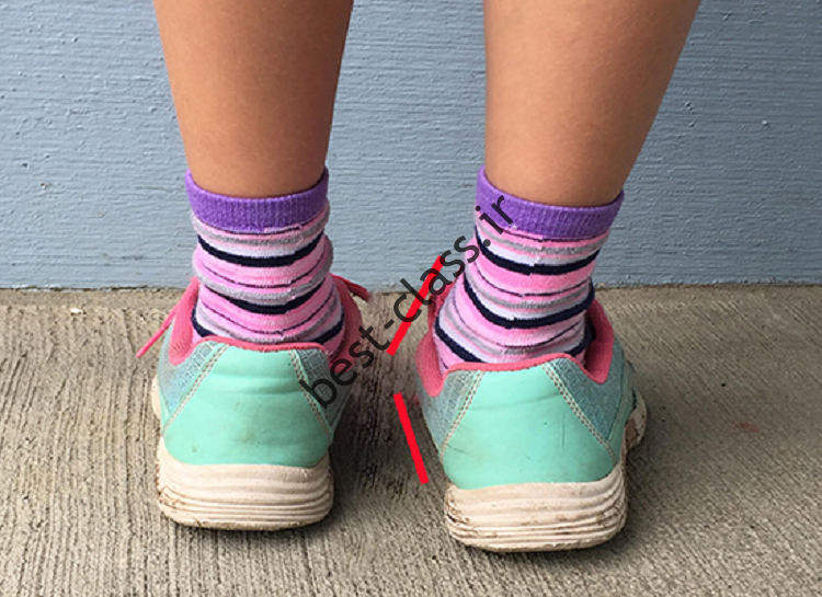 بهترین کفش‌ها برای کودکان با کف پای صاف